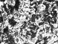 Троостит Структура троостита